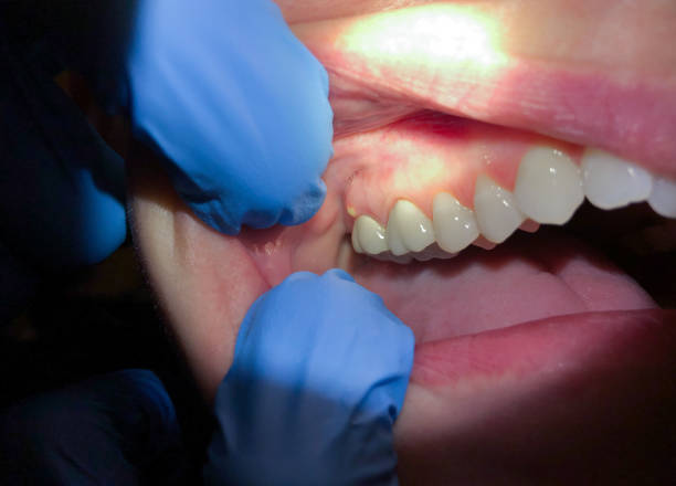 Best Emergency Denture Repair in Pine Crest, TN